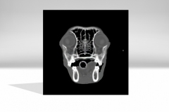 DT_Eye_Brain