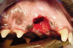 DT_Oronasal_Fistula